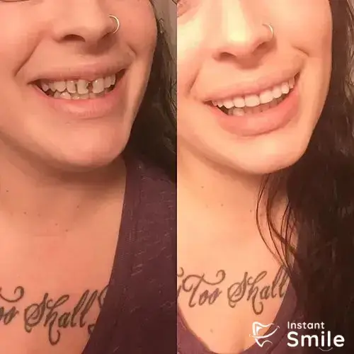 Original instant smile veneers (upper & lower), False teeth veneers cover your damaged teeth for perfect smile instantly, eat drink normally